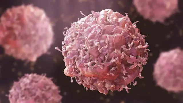 EU records over 40,000 occupational cancer cases in a decade