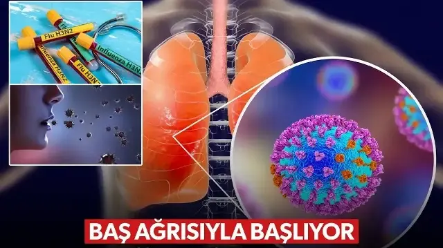 Türkiye'de H3N2 alarmı: Tam 7 kez mutasyona uğradı, baş ağrısıyla başlıyor ölüme kadar götürüyor