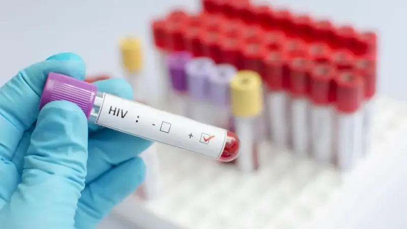 HIV kadınlarda 3 kat fazla görülüyor