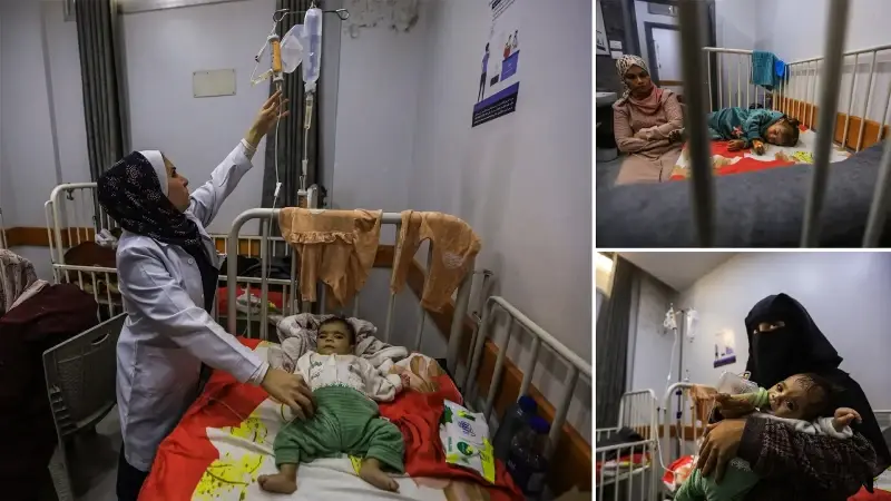 Gazze’de çocuklar ve hamile kadınlar yetersiz beslenme nedeniyle zor durumda