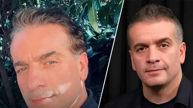 Murat Cemcir'in sağlık durumuyla ilgili yeni gelişme: Hastaneden açıklama geldi