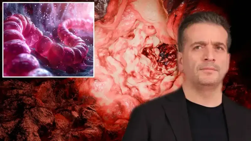 Sinsice ilerliyor! Her 2 kişiden 1’inde görülüyor: Murat Cemcir’i yoğun bakıma götüren iç kanama büyük tehlikeyi gözler önüne serdi