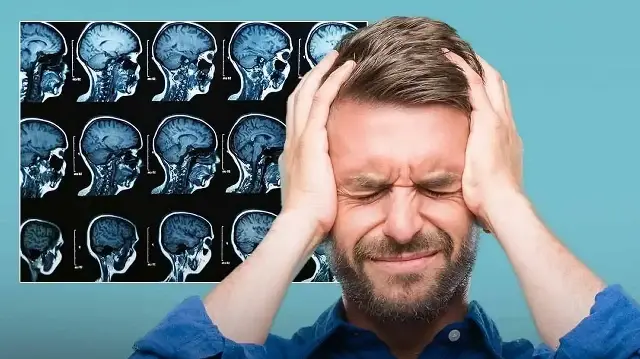 Uzman isim 'Beyni çürütüyor' diyerek uyardı: Yeni salgın yayılıyor her 4 gençten birinde var