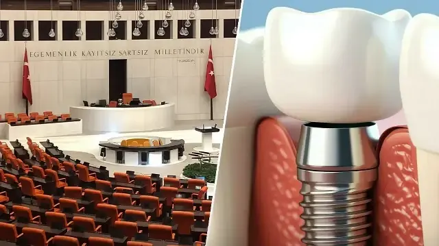 Milyonları ilgilendiren teklif Meclis'e sunuldu: İmplant tedavisini SSK karşılayacak