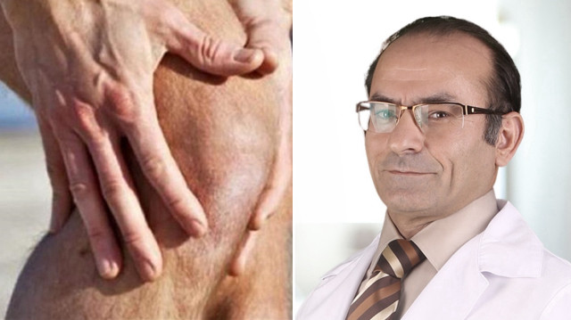 Prof. Dr. Mehmet Soy, iltihaplı romatizmal hastalıkları olanlara uyarıda bulundu.