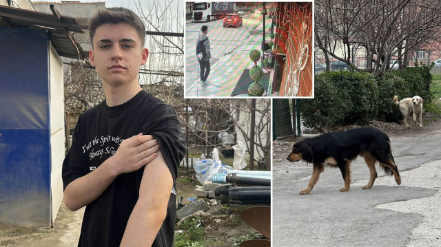 Kolunda ısırık izleri oluşan Akbaş'a burada pansuman yapılarak tetanos aşısı vuruldu. 