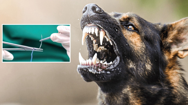 İzmir'de sahipsiz köpeğin saldırısına uğrayan çocuğun koluna dört dikiş atıldı. (Foto: Arşiv)