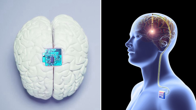 Araştırmada, fare beyinlerine yerleştirilen mikroelektrotlar incelendi.