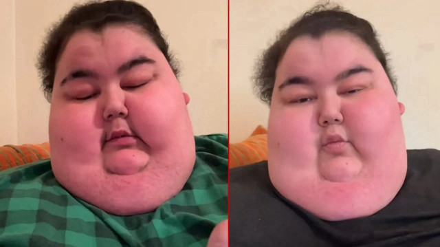 <p>TikTok fenomeni Efecan Kültür, son dönemde yaşadığı sağlık sorunlarıyla gündeme gelmişti.</p>