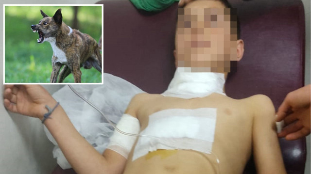 Diyarbakır'da köpeğin saldırısına uğrayan Ahmet P. (10), yaralandı.