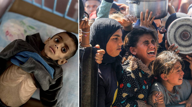 İsrail ablukası nedeniyle Gazze'de çocukların yetersiz beslenme vakaları giderek artıyor.