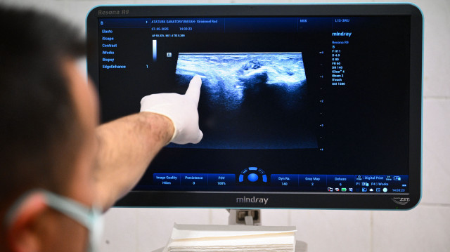 Diz kireçlenmesine anjiyo çözümü: Yüzde 80 hasta memnuniyeti var