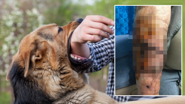 Aksaray'da parktaki yeşil alanda yürüyüşe çıkan 64 yaşındaki adama köpekler saldırdı.