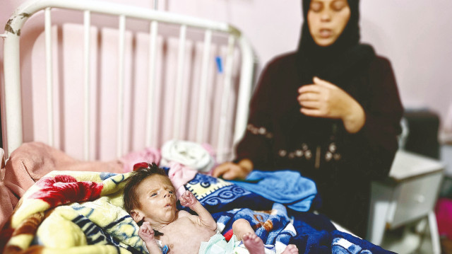 Gazze’de binlerce çocuğun temiz içme suyu ve sağlıklı gıdalara erişemediğini açıklayan Sağlık Bakanlığı, 57 çocuğun da yetersiz beslenmeye bağlı olarak vefat ettiğini bilgisini paylaştı.