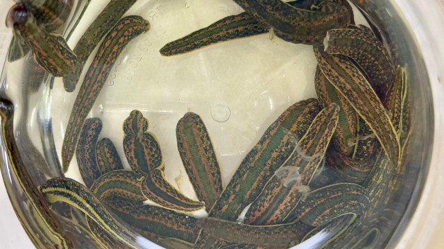 Sülükle tedavi (Hirüdoterapi) ne işe yarar? Kalp krizi riskini azaltıyor mu? Uzmanı açıkladı