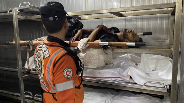 Un médecin examine le corps d'un Palestinien à la morgue de l'hôpital Nasser de Khan Yunis, dans le sud de la bande de Gaza, le 2 juillet 2025. L'armée israélienne a déclaré le 1er juillet qu'elle avait étendu ses opérations à Gaza, où les habitants ont fait état de tirs violents et de bombardements quelques jours avant un voyage prévu à Washington par le Premier ministre Benjamin Netanyahu.