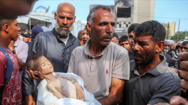 غزہ میں غذائی قلت انتہائی شدت اختیار کر چکی ہے۔