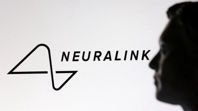 Neuralink планирует вживлять нейрочипы 20 тыс. пациентов ежегодно.
