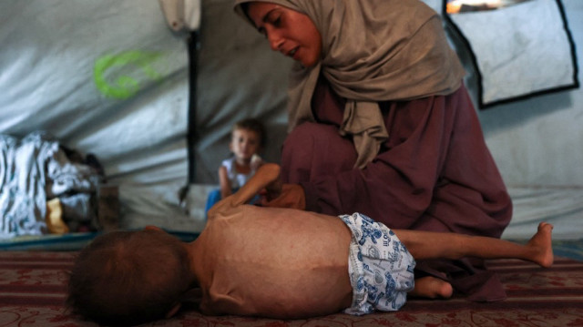 Hidaya, une mère palestinienne de 31 ans, est assise avec son fils Mohammed al-Mutawaq, âgé de 18 mois, qui est malade et présente également des signes de malnutrition, dans leur tente au camp de réfugiés d'Al-Shati, à l'ouest de la ville de Gaza, le 24 juillet 2025.