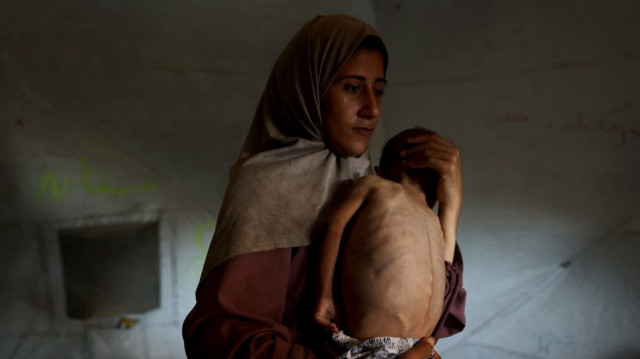 Hidaya, une mère palestinienne de 31 ans, porte son fils Mohammed al-Mutawaq, âgé de 18 mois et malade, qui présente également des signes de malnutrition, à l'intérieur de leur tente dans le camp de réfugiés d'Al-Shati, à l'ouest de la ville de Gaza, le 24 juillet 2025.