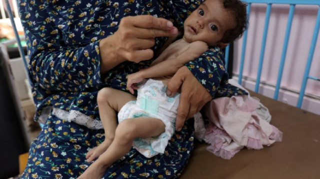 غزة تموت جوعا.. وفاة 5 فلسطينيين بسوء التغذية خلال 24 ساعة