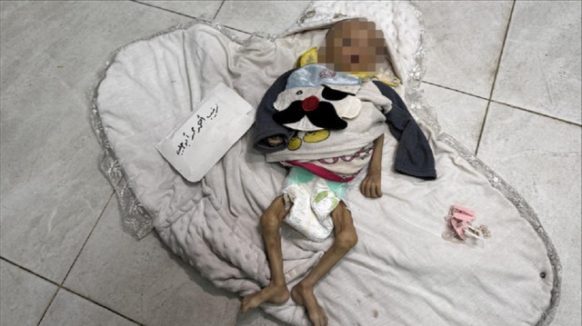 الرضيعة زينب أبو حليب.. ضحية جديدة لتجويع غزة