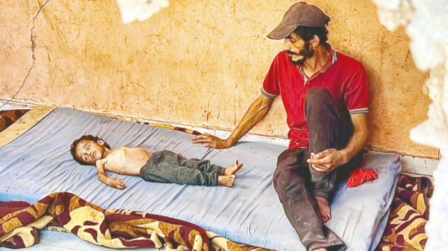 Gazze'de açlıktan ölenlerin sayısı 122'ye ulaştı.