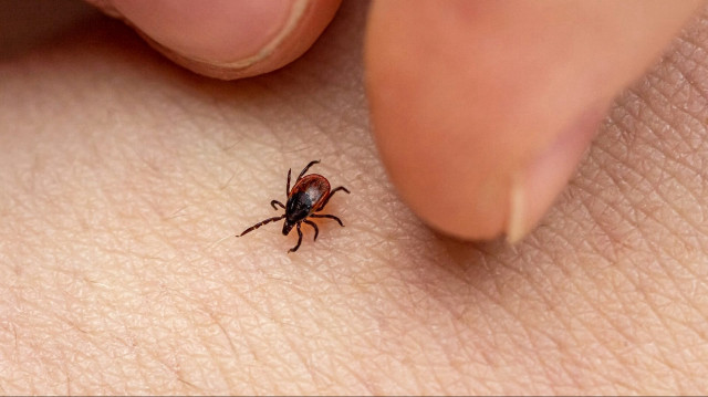 Uzman isim uyardı: Kenede erken ve doğru müdahale, bulaş riskini azaltıyor