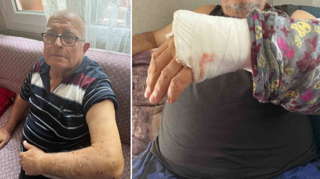 Mehmet Ali Erdan vücudundan saçmalar ile yaralandı.