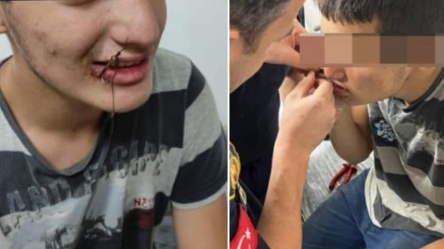 Çocuğun sağlık durumunun iyi olduğu öğrenildi.

