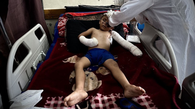 أحمد أبو سحلول.. طفل يواجه الحروق واليتم والجوع في غزة المحاصرة 
