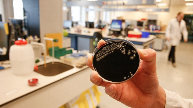 Une photo prise le 17 mai 2019 montre une culture de la bactérie Legionella pneumophila à l'hôpital UZ Gent.
