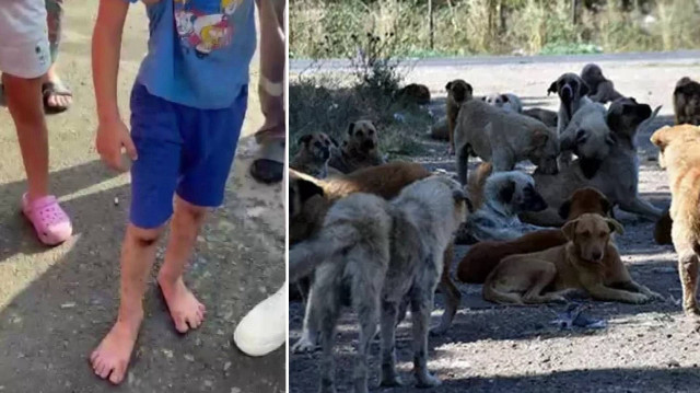 6 yaşındaki çocuk köpeklerin hedefi oldu