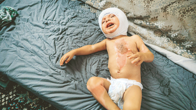 İsrail'in Gazze'ye karşı yaklaşık iki yıldır sürdürdüğü soykırım savaşında 62 binden fazla Filistinli öldürüldü.