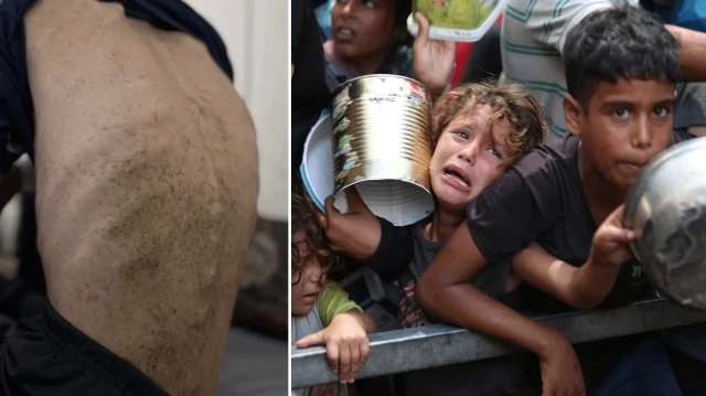 Gazze’de açlık can almaya devam ediyor.