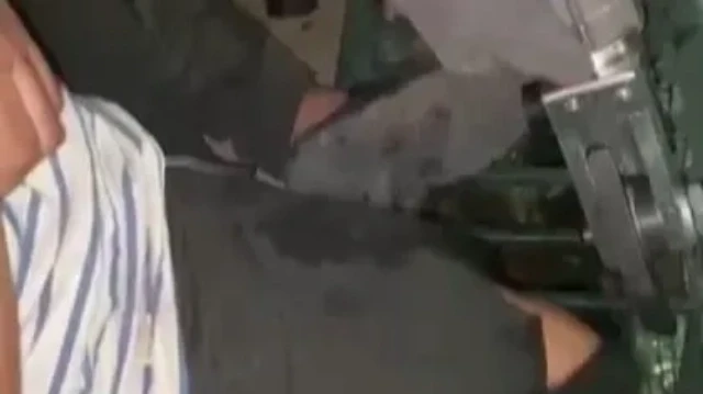 Oyun oynarken bacağı mazgala sıkıştı