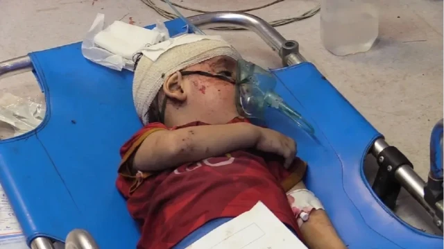 صحة غزة: موجة إنفلونزا قاسية تضرب الأطفال بسبب ضعف مناعتهم