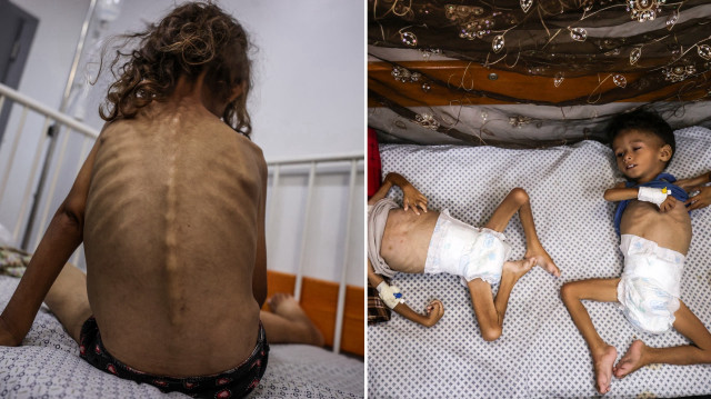 Gazze'de çocuklar açlıkla mücadele ediyor