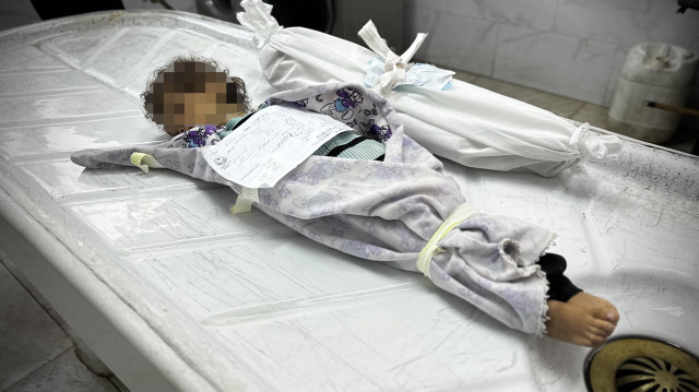 الطفلة "رؤى".. فارقت الحياة بنصف وزنها جراء التجويع الإسرائيلي 