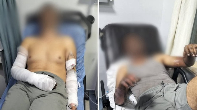 Meydana gelen patlamada 2 kişi ölümden döndü