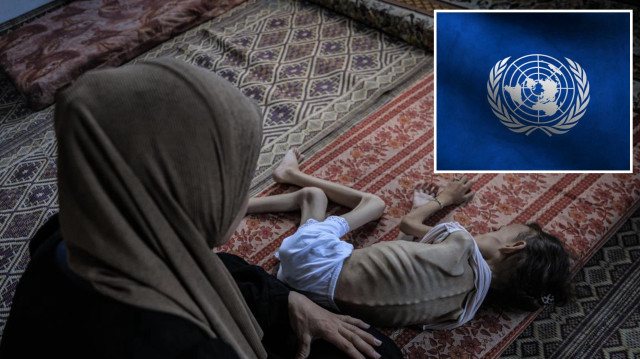 Sadece Temmuz ayında taranan 5 yaş altı 136 bin çocuktan 12 binine akut yetersiz beslenme teşhisi konuldu