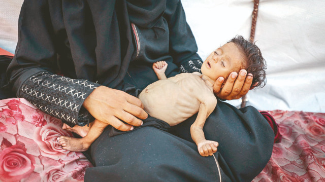 İsrail ordusunun Gazze'ye dün akşam itibariyle son 24 saatte düzenlediği saldırılarda 72 Filistinli hayatını kaybetti, 314 kişi yaralandı.