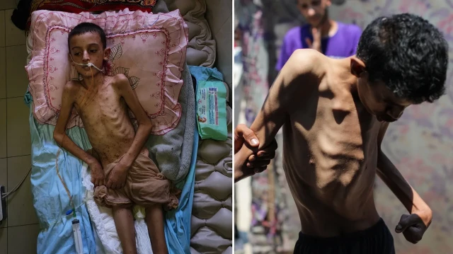 İsrail'in kıtlığı dayattığı Gazze'de son 24 saatte 1'i çocuk 3 kişi daha açlıktan hayatını kaybetti.