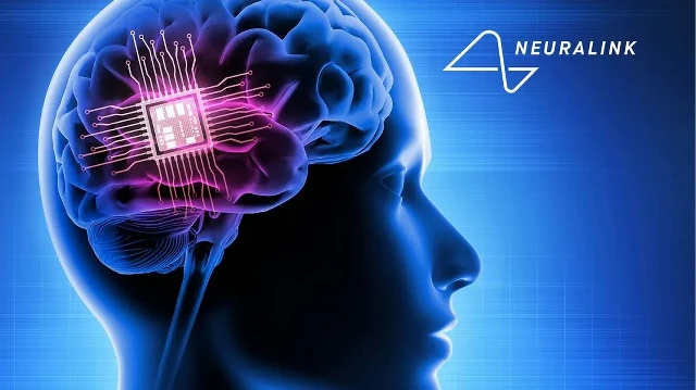 Neuralink готовится испытать технологию прямого перевода мыслей в речь | Фото: Shutterstock