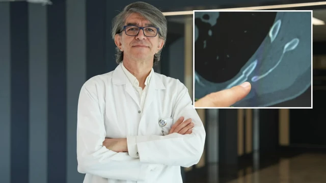 Uzman isim, öksürük sonrası göğüs ağrısını ihmal etmeyin uyarısında bulundu.