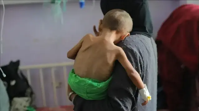 صحة غزة: ارتفاع وفيات التجويع الإسرائيلي إلى 453 بينهم 150 طفلا