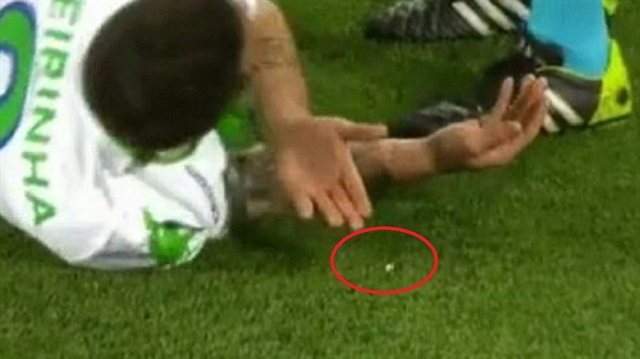 Wolfsburg-Real Madrid maçında Portekizli futbolcu Vierinha'nın dişi kırıldı.