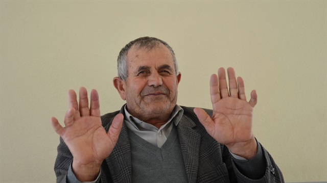 Normal insanlardan 4 tane daha fazla parmağı olan Ali İhsan Özdemir durumundan memnun olduğunu söyledi.
