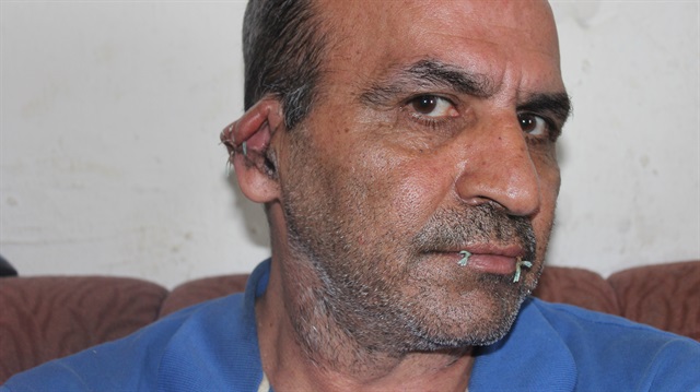 İranlı sığınmacı, BM'ye sesini duyurabilmek için kulaklarını ve ağzını dikti. 
