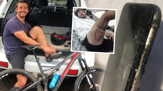 36 yaşındaki bisikletçi Gareth Clear'ın cebindeki iPhone 6'nın bataryası patladı.
